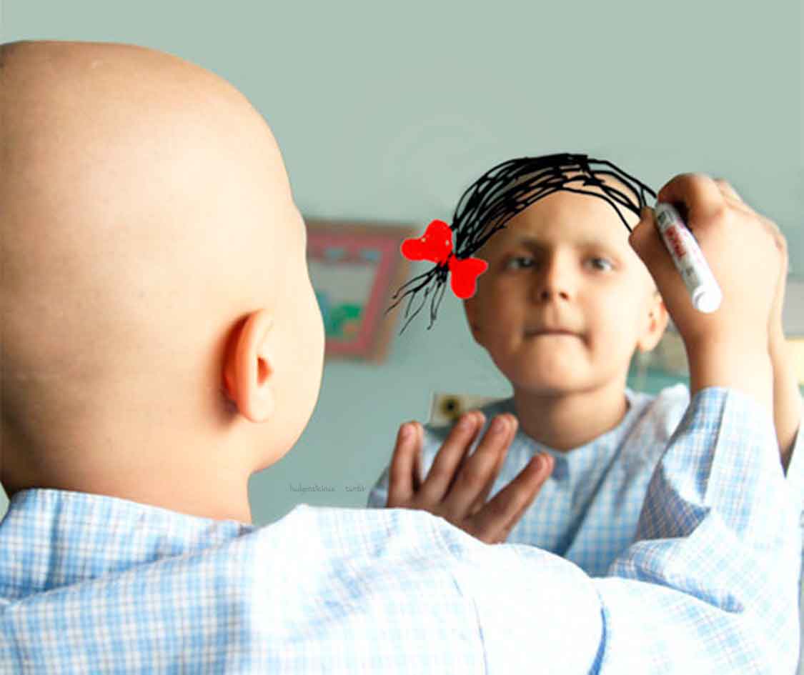 Inicia IMSS plan para combatir cáncer infantil