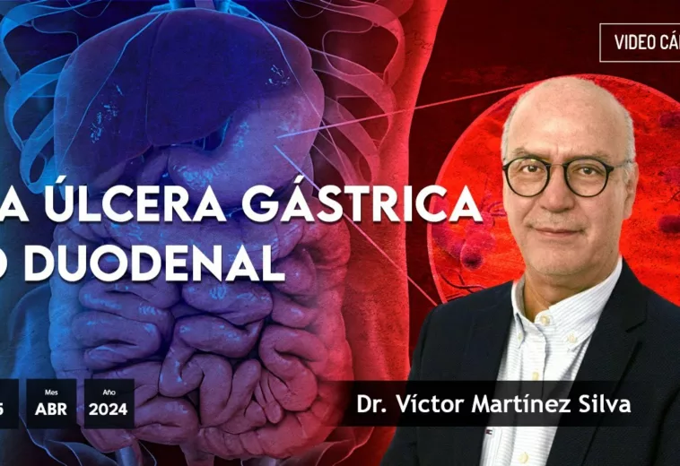 La Úlcera gástrica o duodenal - #VideoOpinión Dr. Víctor Martínez Silva